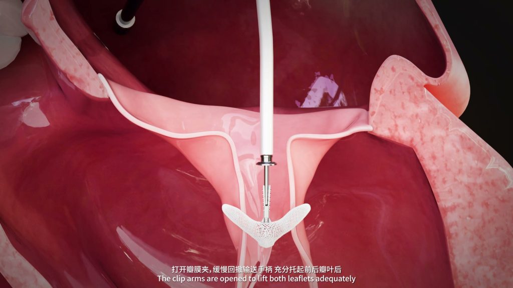 幻界元素医疗动画制作